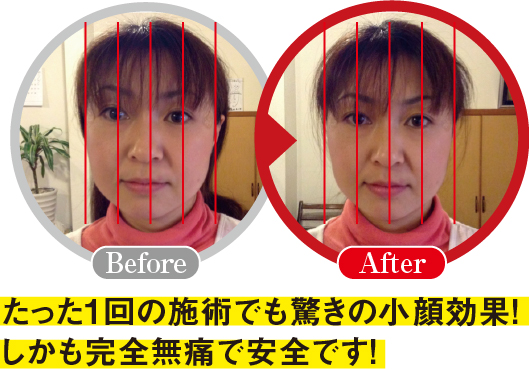 ʐ^FBefore After
